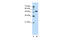 SRY-Box 11 antibody, 28-826, ProSci, Western Blot image 