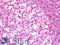 RPA32 antibody, LS-B11051, Lifespan Biosciences, Immunohistochemistry paraffin image 
