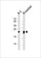 Crystallin Beta B2 antibody, PA5-49374, Invitrogen Antibodies, Western Blot image 