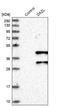 Deleted in azoospermia-like antibody, NBP1-85307, Novus Biologicals, Western Blot image 