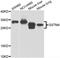 Glutathione S-transferase Mu 4 antibody, A7434, ABclonal Technology, Western Blot image 