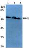 Kruppel Like Factor 11 antibody, GTX66649, GeneTex, Western Blot image 