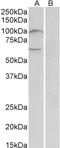 Unc-5 Netrin Receptor B antibody, TA326748, Origene, Western Blot image 