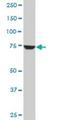 Cleavage And Polyadenylation Specific Factor 3 antibody, H00051692-M01, Novus Biologicals, Western Blot image 