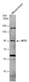 Inturned Planar Cell Polarity Protein antibody, GTX120239, GeneTex, Western Blot image 