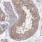 Kinesin Family Member 5C antibody, HPA062272, Atlas Antibodies, Immunohistochemistry frozen image 