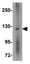 Regulating Synaptic Membrane Exocytosis 2 antibody, GTX85035, GeneTex, Western Blot image 