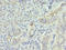 Inositol Polyphosphate-1-Phosphatase antibody, A59482-100, Epigentek, Immunohistochemistry paraffin image 