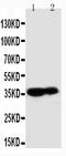 Kallikrein Related Peptidase 9 antibody, PA1820, Boster Biological Technology, Western Blot image 
