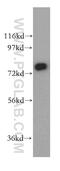 Synaptotagmin-17 antibody, 15413-1-AP, Proteintech Group, Western Blot image 