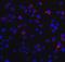 DExD/H-Box Helicase 58 antibody, GTX85488, GeneTex, Immunofluorescence image 