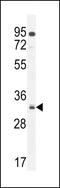 Nucleolar And Spindle Associated Protein 1 antibody, 55-549, ProSci, Western Blot image 