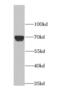 Amyloid Beta Precursor Like Protein 1 antibody, FNab00486, FineTest, Western Blot image 