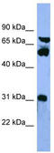 Cytochrome P450 Family 8 Subfamily B Member 1 antibody, TA342856, Origene, Western Blot image 