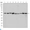 Chaperonin Containing TCP1 Subunit 2 antibody, LS-C814039, Lifespan Biosciences, Western Blot image 