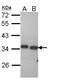 Peroxisomal Trans-2-Enoyl-CoA Reductase antibody, LS-C109471, Lifespan Biosciences, Western Blot image 