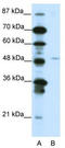 Homeobox protein MOX-2 antibody, TA343569, Origene, Western Blot image 