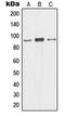 Minichromosome Maintenance Complex Component 5 antibody, LS-C352495, Lifespan Biosciences, Western Blot image 