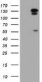 Cytosolic carboxypeptidase 1 antibody, TA800251BM, Origene, Western Blot image 