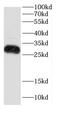 Killer Cell Lectin Like Receptor D1 antibody, FNab01509, FineTest, Western Blot image 