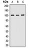 Desmocollin 2 antibody, LS-C667759, Lifespan Biosciences, Western Blot image 