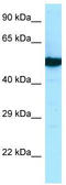 Tubulin Beta 2B Class IIb antibody, TA337744, Origene, Western Blot image 