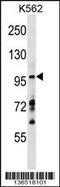 Myosin VIIA And Rab Interacting Protein antibody, 58-994, ProSci, Western Blot image 