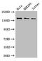 Sca2 antibody, LS-C501686, Lifespan Biosciences, Western Blot image 