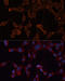Inositol Polyphosphate-5-Phosphatase B antibody, 19-218, ProSci, Immunofluorescence image 