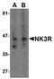 Tachykinin Receptor 3 antibody, AP05734PU-N, Origene, Western Blot image 