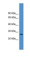 Uncharacterized protein C1orf183 antibody, orb326235, Biorbyt, Western Blot image 