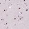 Histone-lysine N-methyltransferase SETD1A antibody, PA5-63563, Invitrogen Antibodies, Immunohistochemistry frozen image 