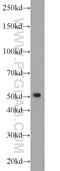SIL1 Nucleotide Exchange Factor antibody, 24110-1-AP, Proteintech Group, Western Blot image 