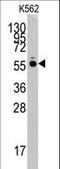 Histidyl-TRNA Synthetase antibody, LS-C100191, Lifespan Biosciences, Western Blot image 