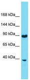 Ring Finger Protein 216 antibody, TA344581, Origene, Western Blot image 