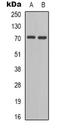BLNK antibody, orb338962, Biorbyt, Western Blot image 