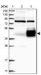 Leucine Rich Repeat Containing 17 antibody, PA5-56361, Invitrogen Antibodies, Western Blot image 