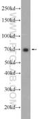 Antigen peptide transporter 1 antibody, 11114-1-AP, Proteintech Group, Western Blot image 
