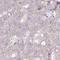 Myotubularin Related Protein 14 antibody, HPA054063, Atlas Antibodies, Immunohistochemistry paraffin image 