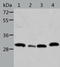 STE20 Related Adaptor Beta antibody, TA324160, Origene, Western Blot image 