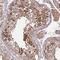 Zinc Finger Protein 624 antibody, PA5-54728, Invitrogen Antibodies, Immunohistochemistry frozen image 