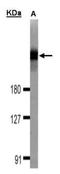 Dedicator of cytokinesis protein 1 antibody, TA308798, Origene, Western Blot image 