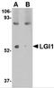 Leucine Rich Glioma Inactivated 1 antibody, 4531, ProSci, Western Blot image 