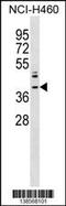 Zinc Finger Protein 75a antibody, 59-886, ProSci, Western Blot image 