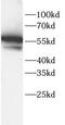Alkaline Phosphatase, Biomineralization Associated antibody, FNab10377, FineTest, Western Blot image 