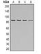 Signal Transducer And Activator Of Transcription 1 antibody, orb338823, Biorbyt, Western Blot image 