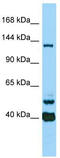 Calmodulin-regulated spectrin-associated protein 3 antibody, TA331808, Origene, Western Blot image 