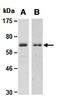 Protein Inhibitor Of Activated STAT 1 antibody, orb66685, Biorbyt, Western Blot image 