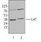 Linker For Activation Of T Cells antibody, TA327925, Origene, Western Blot image 