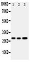 Oncostatin M antibody, PA1668, Boster Biological Technology, Western Blot image 